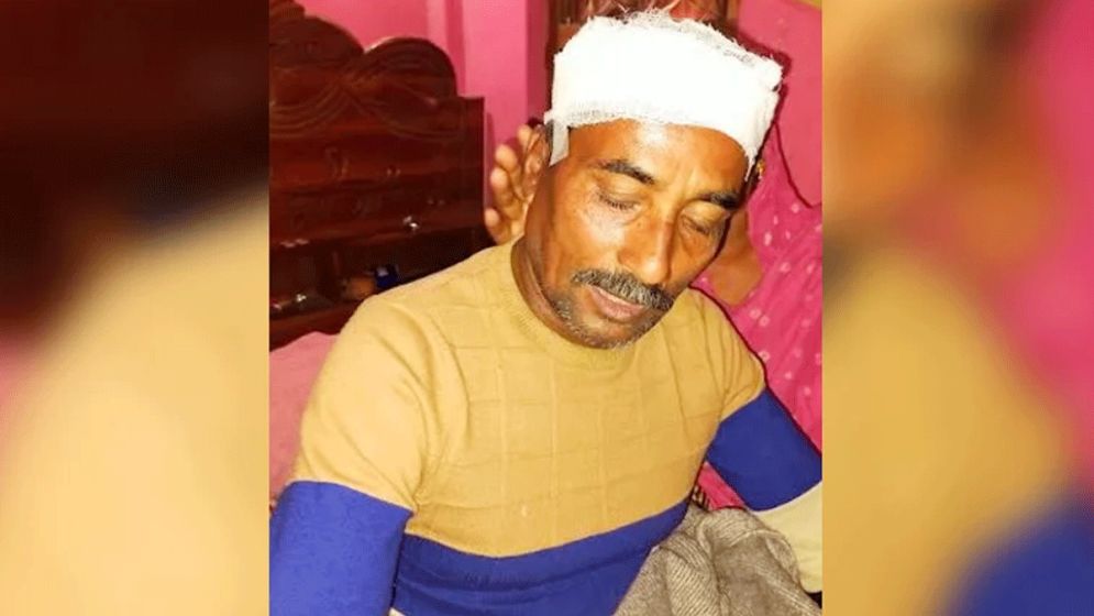 হাতুড়িপেটায় আহত সেই যুবদল কর্মীর মৃত্যু