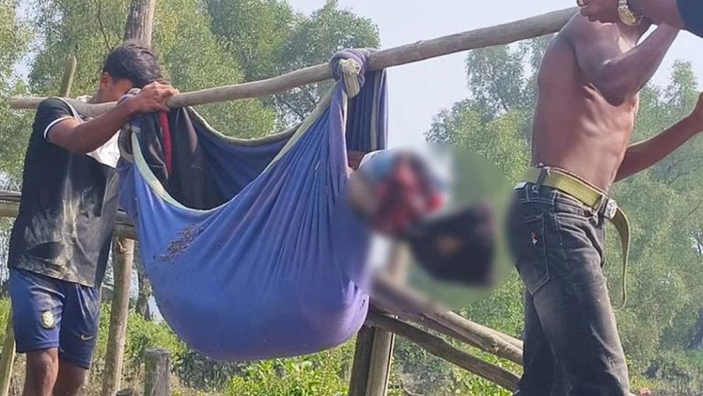 টেকনাফে মাইন বিস্ফোরণে বাংলাদেশি যুবকের পা বিচ্ছিন্ন