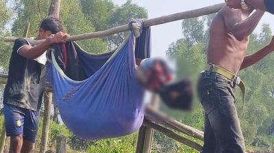 টেকনাফে মাইন বিস্ফোরণে বাংলাদেশি যুবকের পা বিচ্ছিন্ন