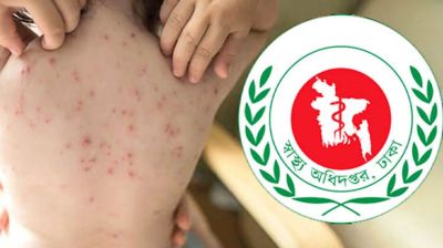 হামে আক্রান্ত ও উপসর্গ নিয়ে ৪ জনের মৃত্যু, আক্রান্ত ১১৯৭